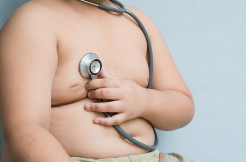 Obesità: in Italia colpito 1 bambino su 3. Dati in peggioramento